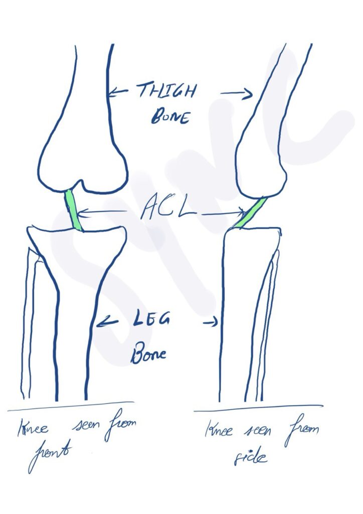 Normal Anterior Cruciate Ligament(ACL)